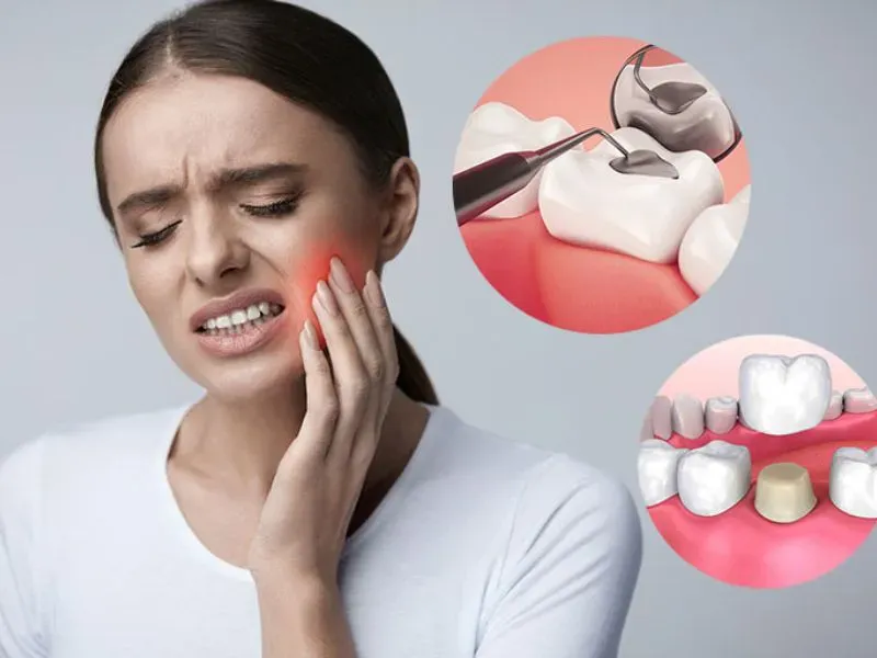 Nên bọc răng sứ hay trám răng khi sâu răng?