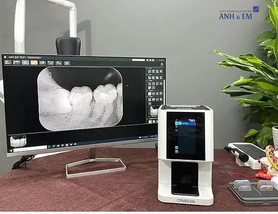 Phân tích chuyên sâu về hiệu năng chẩn đoán và độ nhạy của hệ thống đĩa lưu trữ phospho (PSP) trong việc phát hiện tổn thương sâu răng kẽ giai đoạn sớm: từ cơ sở kỹ thuật đến ứng dụng lâm sàng và quản lý sức khỏe cộng đồng